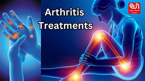 Arthritis Treatments How To Get Pain Relief From Arthritis One World