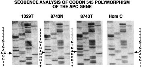 Sequence Analysis Of Codon 545 Polymorphism Of The APC Gene This