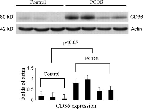 Western Blot Showing Fatty Acid Transporter Cd36 Protein Expression In Download Scientific