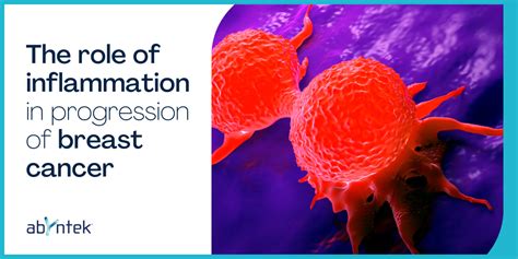 Inflammation In Progression Of Breast Cancer Abyntek