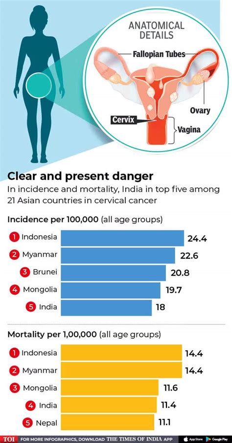 Infographic Cervical Screening Cervical Cancer On The Rise India