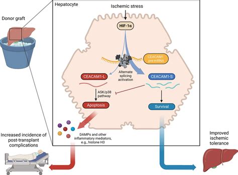 Spliced Ceacam A Potential Novel Biomarker And Target For