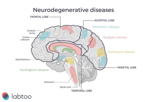 Neurodegenerative Disorders Research And Therapies