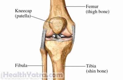 Patella Fracture Definition, Causes, Symptoms, Complications and Cost ...