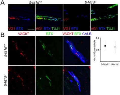 Normal Innervation Of Muscle Spindles In 5 Ht1d − − Mice Download