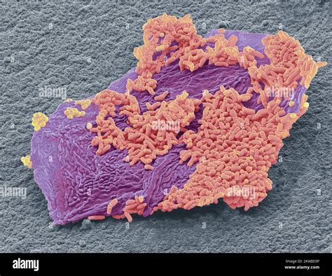 Athlete's foot fungus, SEM Stock Photo - Alamy