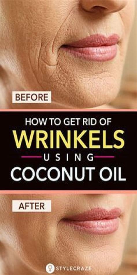 How To Get Rid Of Wrinkles Using Coconut Oil Petrusevska Stefanija