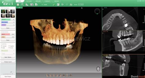 Dentmed Centrum Implantologii I Stomatologii Estetycznej Dentysta