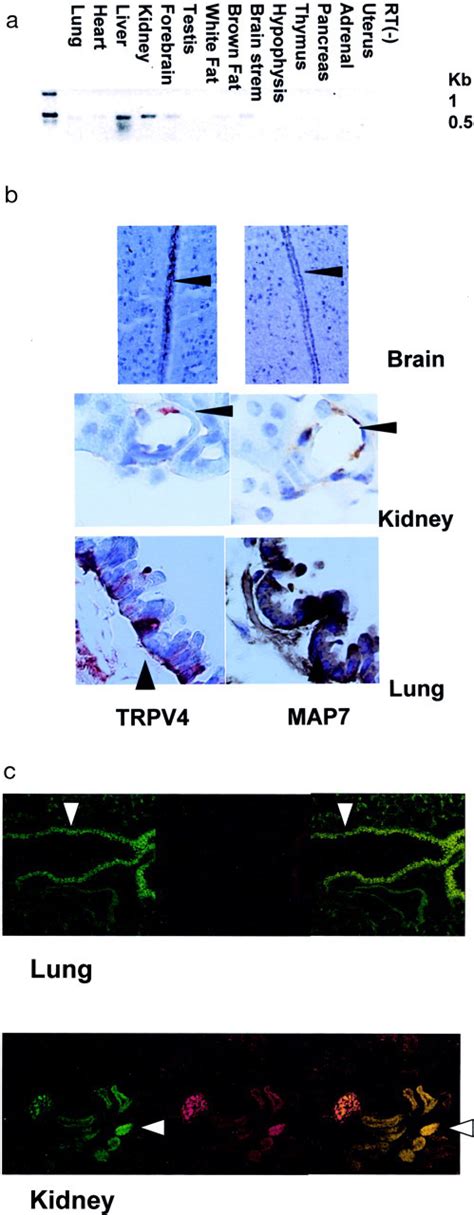 Microfilament Associated Protein 7 Increases The Membrane Expression Of