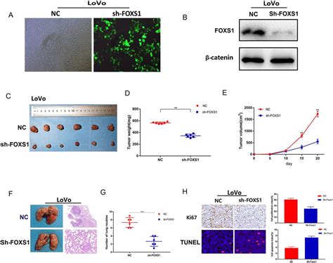 FOXS1 Knockdown Inhibited Tumor Growth And Tumour Metastasis In Vivo A