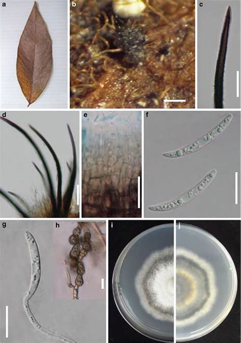 Colletotrichum Fusiforme Facesoffungi Number FoF 00851 Faces Of Fungi