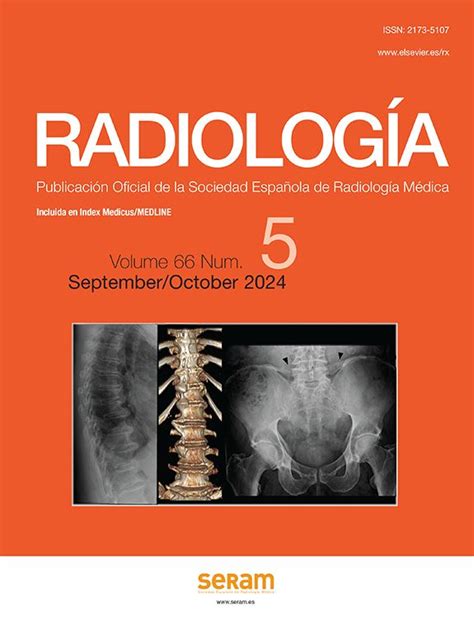 Gynecological Pelvic Pain As Emergency Pathology Radiología English