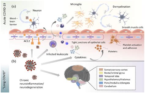 Neurological Manifestations Of Long Covid Syndrome A Narrative Review