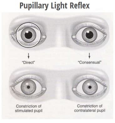 pupillary-light-reflex – Jaya Eye Care Centre is an NABH Accredited Eye Care Hospital