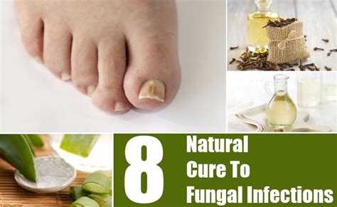 8 Natural Cures For Fungal Infections How To Cure Fungal Infections Naturally Natural Home