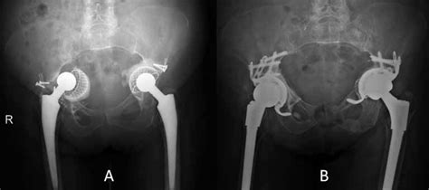 Representative Radiology Images A Representative Preoperative Download Scientific Diagram