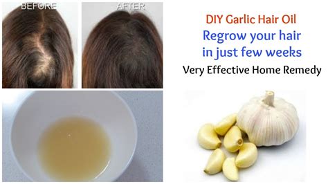 Diy Garlic Hair Oil For Super Hair Growth Regrow Your Hair