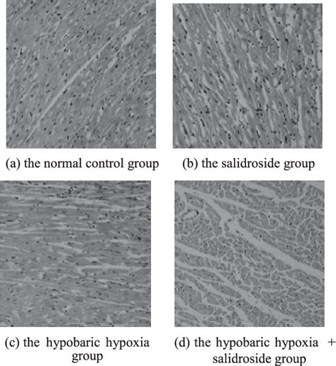 Figure From Mechanism Of Salidroside Relieving The Acute Hypoxia