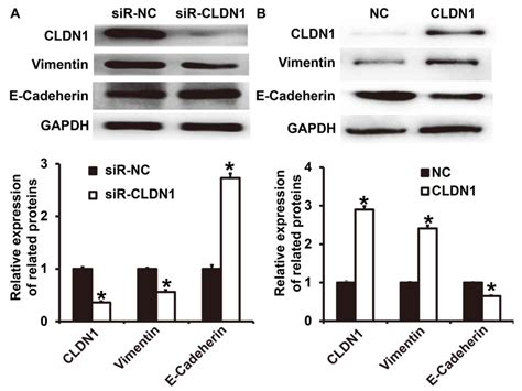 Claudin1 Promotes The Proliferation Invasion And Migration Of