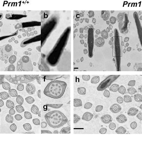 Sperm Morphology As Indicated By Eosin Staining And Scanning Electron Download Scientific