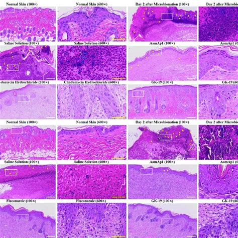 The histology analysis of skin samples of the scalded mice infected by ...