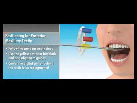 Dentsply Rinn XCP DS FIT Dentrek Module YouTube