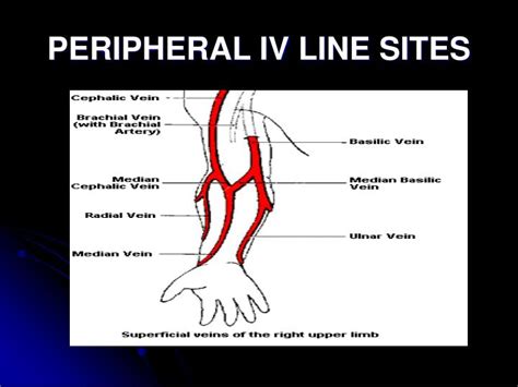 PPT - INTRAVENOUS THERAPY PowerPoint Presentation - ID:692730