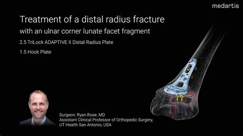 Treatment of a distal radius fracture with an ulnar corner lunate facet ...