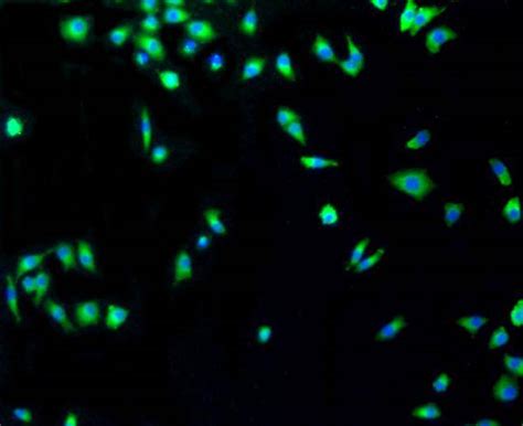 P53 Rabbit MAb SAB Signalway Antibody