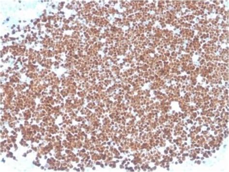 TdT Antibody TDT 1393 Azide and BSA Free Novus Biologicals 100 μg