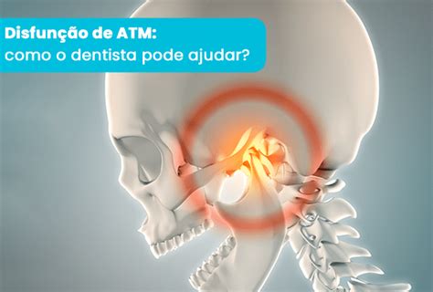 Disfunção de ATM como o dentista pode ajudar Blog Odonto Equipamentos