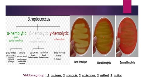 Dentosphere : World of Dentistry: Streptococcus mutans and Dental Caries