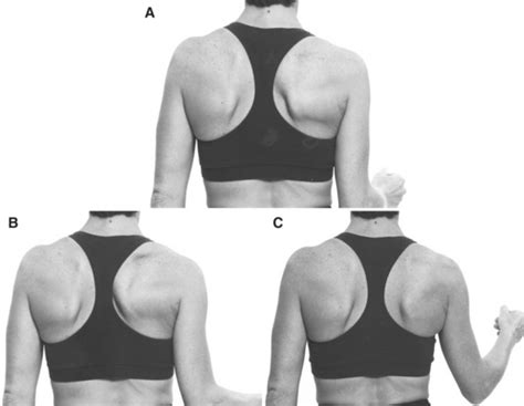 Shoulder Girdle Elevation