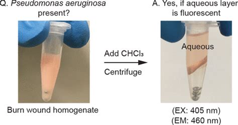 Pseudomonas Aeruginosa Burn Infection