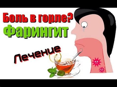 Боль в горле при глотании. Лечение фарингита - YouTube