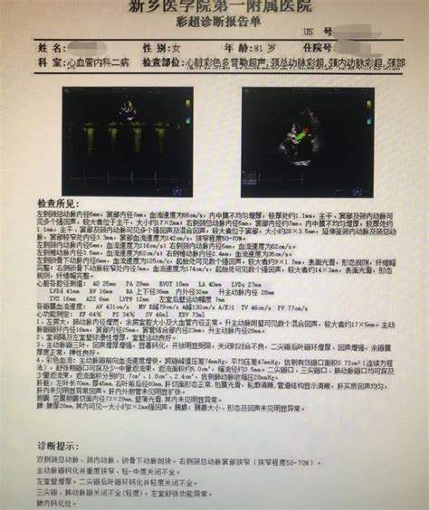 新乡医学院第一附属医院心血管内科二病区连续工作6小时，顺利完成两台tavr手术，成功救治两位主动脉瓣重度狭窄患者 严道医声网