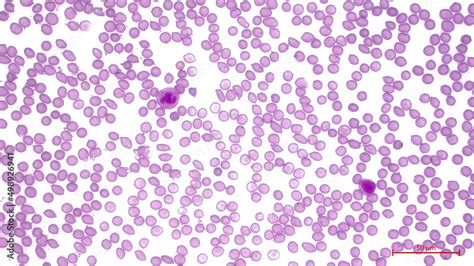 Light Micrograph Showing Human Blood Cells Blood Smear Erythrocytes