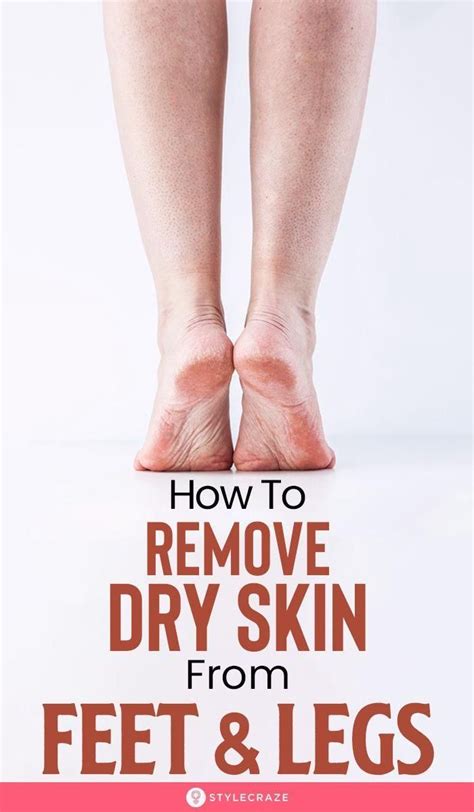 How To Remove Dry Skin From Your Feet And Legs Remediesfordrylips Dry