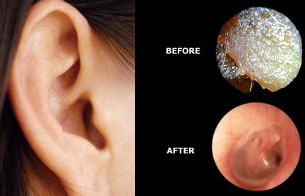 Ear Care Centre – We can help you with