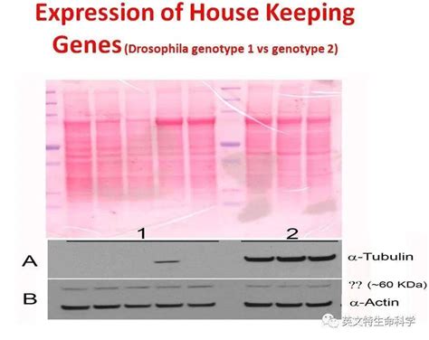 Gapdh，tubulin，actin选哪个做wb内参更好？实验组织蛋白质