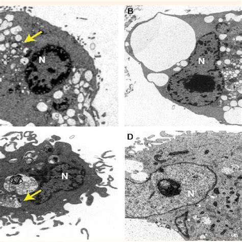 A–D: Transmission electron microscopy ultrastructural analysis at ... 
