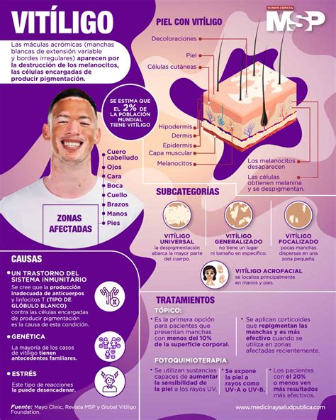 Vitiligo Infografía