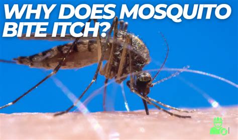 Why Does Mosquito Bite Itch Symptoms And Solutions Explained Y L P C