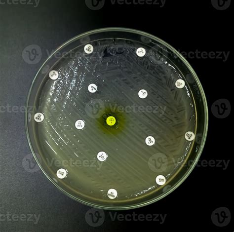 Antimicrobial Susceptibility Testing In Petri Dish Antibiotic