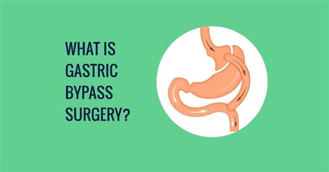 Gastric Bypass Surgery Australia | What is gastric bypass surgery