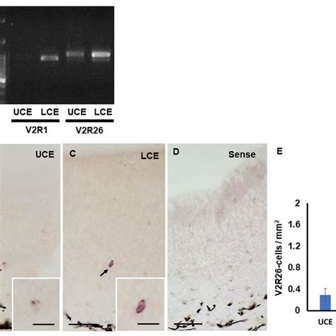 Reverse Transcription Polymerase Chain Reaction Analysis For The