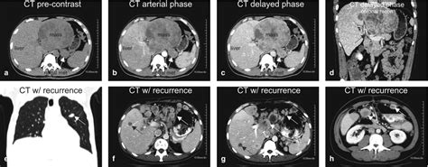 Liver Lesions Radiology Key