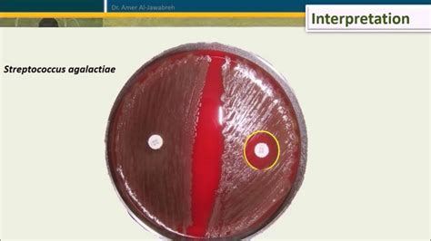 Bacitracin Test For Streptococcus Pyogenes Streptococcus Pyogenes