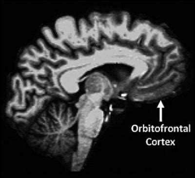 Personality Brain Aging Orbitofrontal Cortex EurekAlert