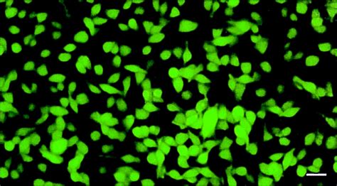 Whole Body Optical Imaging Of Green Fluorescent Protein Expressing